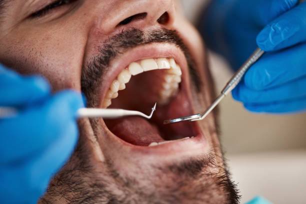 Best Urgent Care for Lost Fillings or Crowns in Wabasso, FL